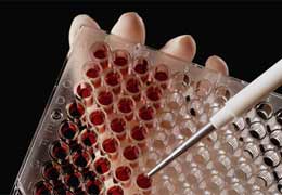 Expert: Armenia reaches high level Viral Safety of blood donation