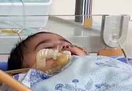 Injured baby from Gyumri dies