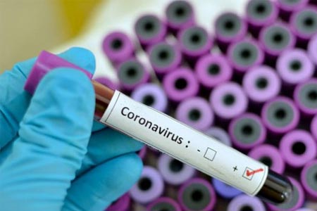 Минздрав: Все проведенные в Арцахе тесты на коронавирус дали отрицательный результат
