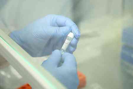 Ministry of Healthcare: Armenia has sufficient number of tests to  detect coronavirus 