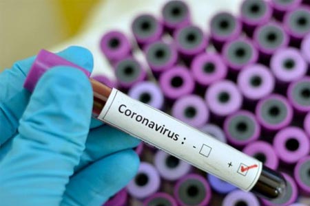 За истекшие сутки в Армении подтверждено 200 новых случаев заболевания COVID-19