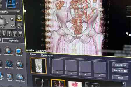 Attempted smuggling of cocaine from the Netherlands to Armenia  thwarted